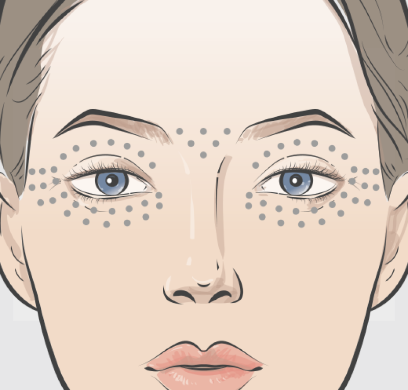 Plinest Eye Product Specs Images
